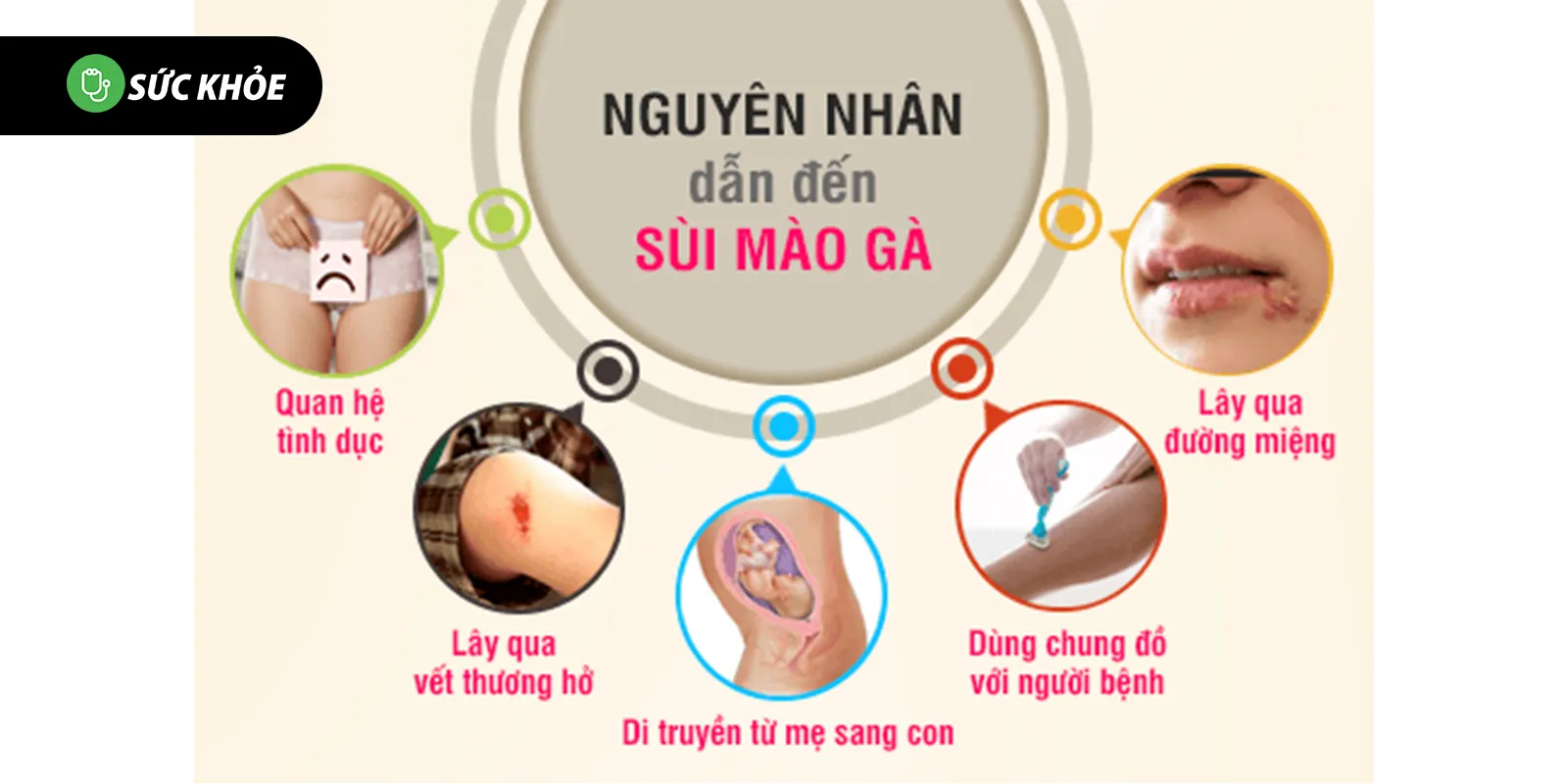 nguyên nhân sùi mào gà