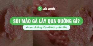 sùi mào gà lây qua đường gì