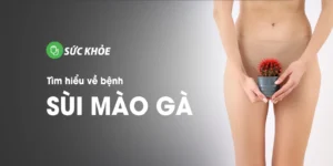 sùi mào gà là gì
