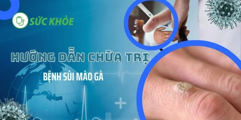 hướng dẫn chữa trị