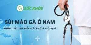 sùi mào gà ở nam