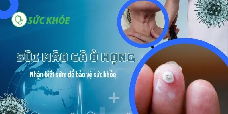 Sùi mào gà ở họng